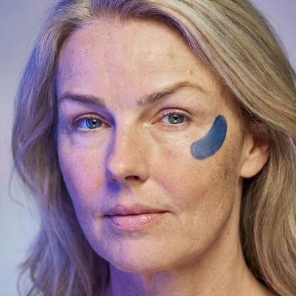 Micro-Infusion Patches (Uitverkoop)